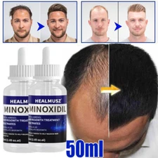 2 Bottles Minoxidil 5% Extra Strength Men Hair Regrowth Solution, 2 Month Supply