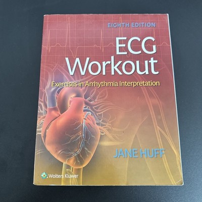 ECG Workout : Exercises in Arrhythmia Interpretation with code 
