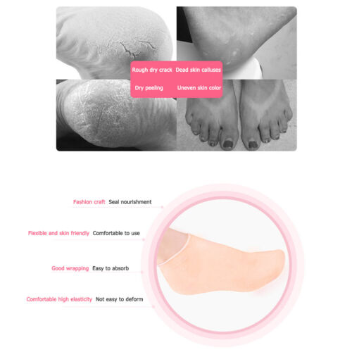 5# 1 Pair Foot Care Socks Moisturizing Gel Cracked Skin Protectors Socks (L) - Picture 1 of 11