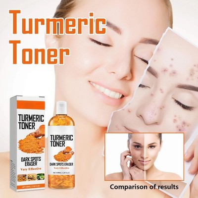 Organic Turmeric Toner Hydrating Moisturizing Liquid Spray for All Skin Types