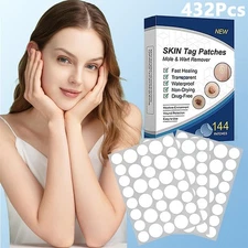 432PC Skin Tag Remover Patches Quick Effective Mole Wart Removal Pad Sticker Hot