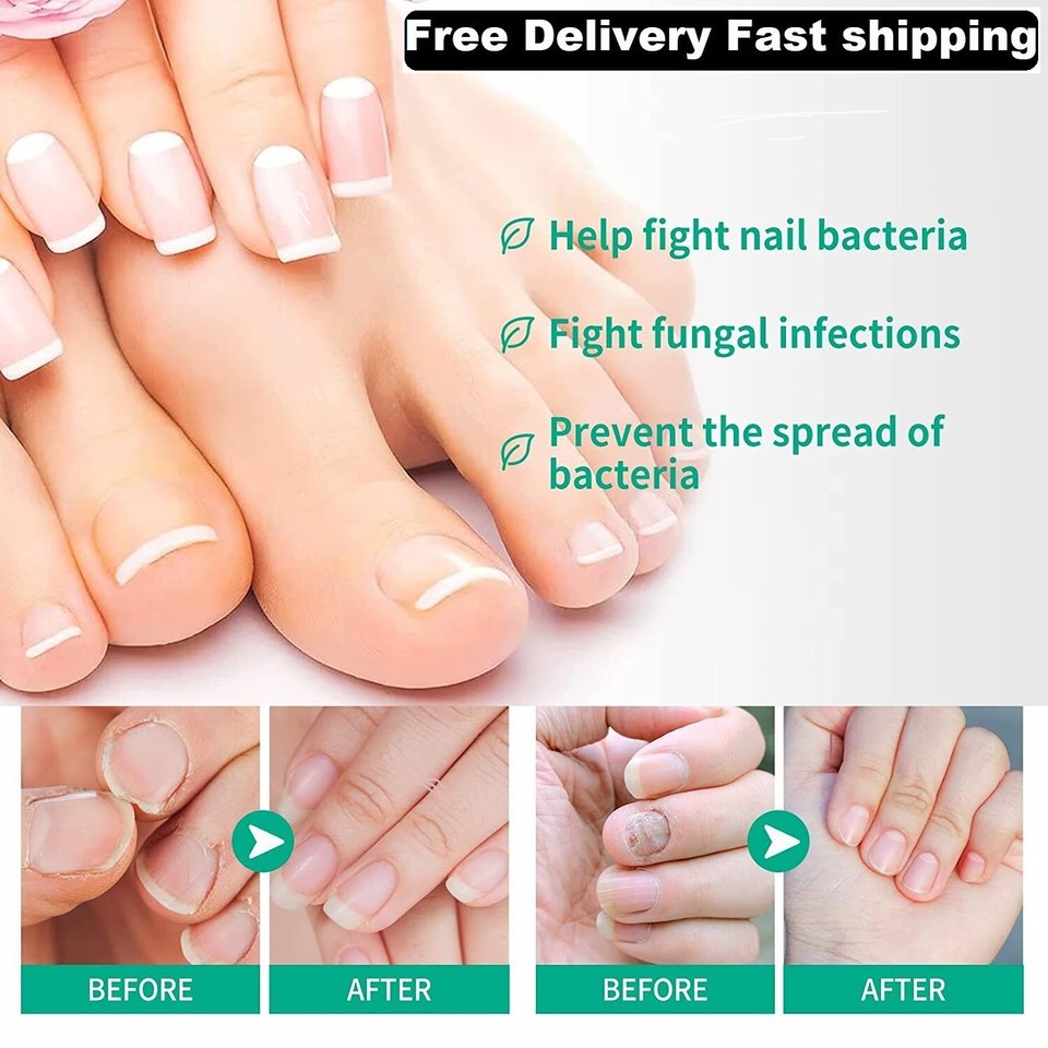 Kerassentials For Toenail Fungus Kerassentials Toenail Fungus Kerassentials for toenail fungus kerassentials toenail fungus
