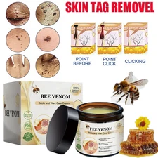 Bee Venom Skin Tag Removal Treatment Cream Body Care Mole Corn Wart Remover