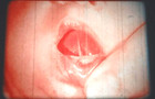 16mm film: EXAMINING THE NEWBORN - 1964 PFIZER PRODUCTION Classic Lesson RARE! — photo 4
