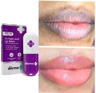 🔥 The Derma Co 1% Kojic Acid Lip Balm 4g Brighten Dark Lips • Smooth • Hydrate