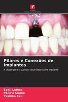 Sahil Luthra (U. A.) | Pilares E ConexõEs De Implantes | Taschenbuch (2022)