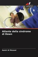Aamir Al Mosawi | Atlante Della Sindrome Di Down | Taschenbuch | Italienisch
