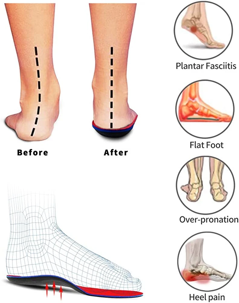 Best sole inserts shop for flat feet
