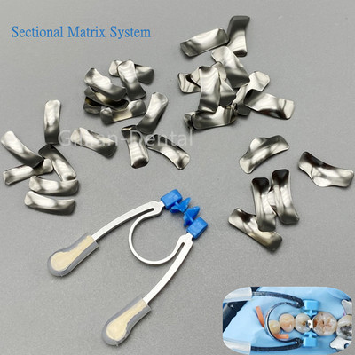 Dental Sectional Matrix System Metal Matrix Bands Refill +1Pc Blue Clip Ring