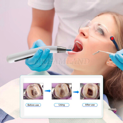 Endo Ultra Activator Irrigation Root Canal Irrigator Tips Ultrasonic