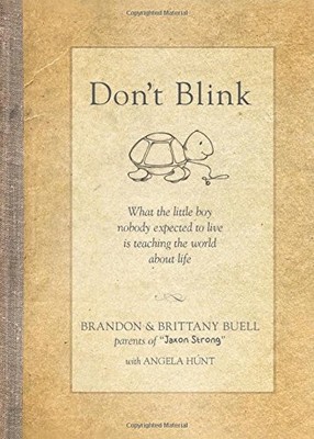 Dont Blink: What the Little Boy Nobody Expected to Live Is Teaching - VERY GOOD