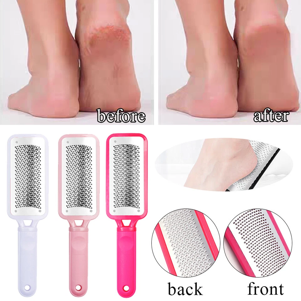 Foot File Scraper Rasp Hard Dead Dry Skin Remover Grater Callus Pedicure Tool US - Image 2 of 4