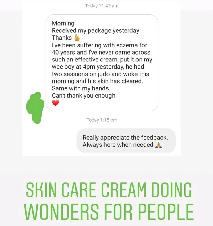 Eczema,Psoriasis,Dry Skin,Acne,Rash Superior Skin Care Cream. 120mls Large Tub - Image 3 of 4