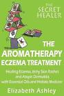 The Aromatherapy Eczema Treatment: The Professional Aromatherapist's Guide to Healing Eczema, Itchy Skin Rashes and Atopic Dermatitis with Essential Oils and Holistic Medicine. by Mrs Elizabeth Ashley (Paperback / softback, 2015)
