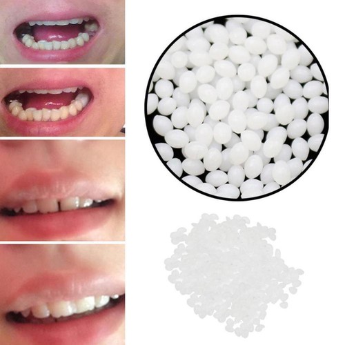 Temporary Tooth Replacement Material - Teeth Repair Grams, 20ml 12 - - HOT F0S7 - Picture 4 of 9