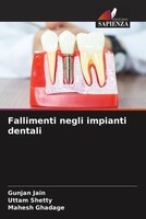 Gunjan Jain (U. A.) | Fallimenti Negli Impianti Dentali | Taschenbuch (2022)