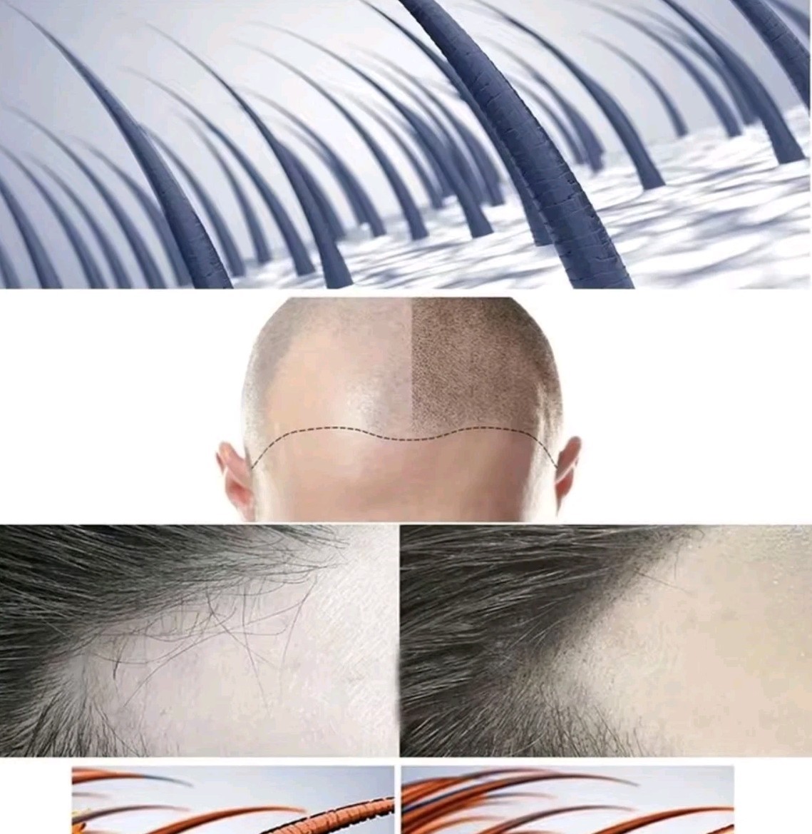 Trattamento Intensivo Biotina 50ml - Siero Crescita Barba e Capelli