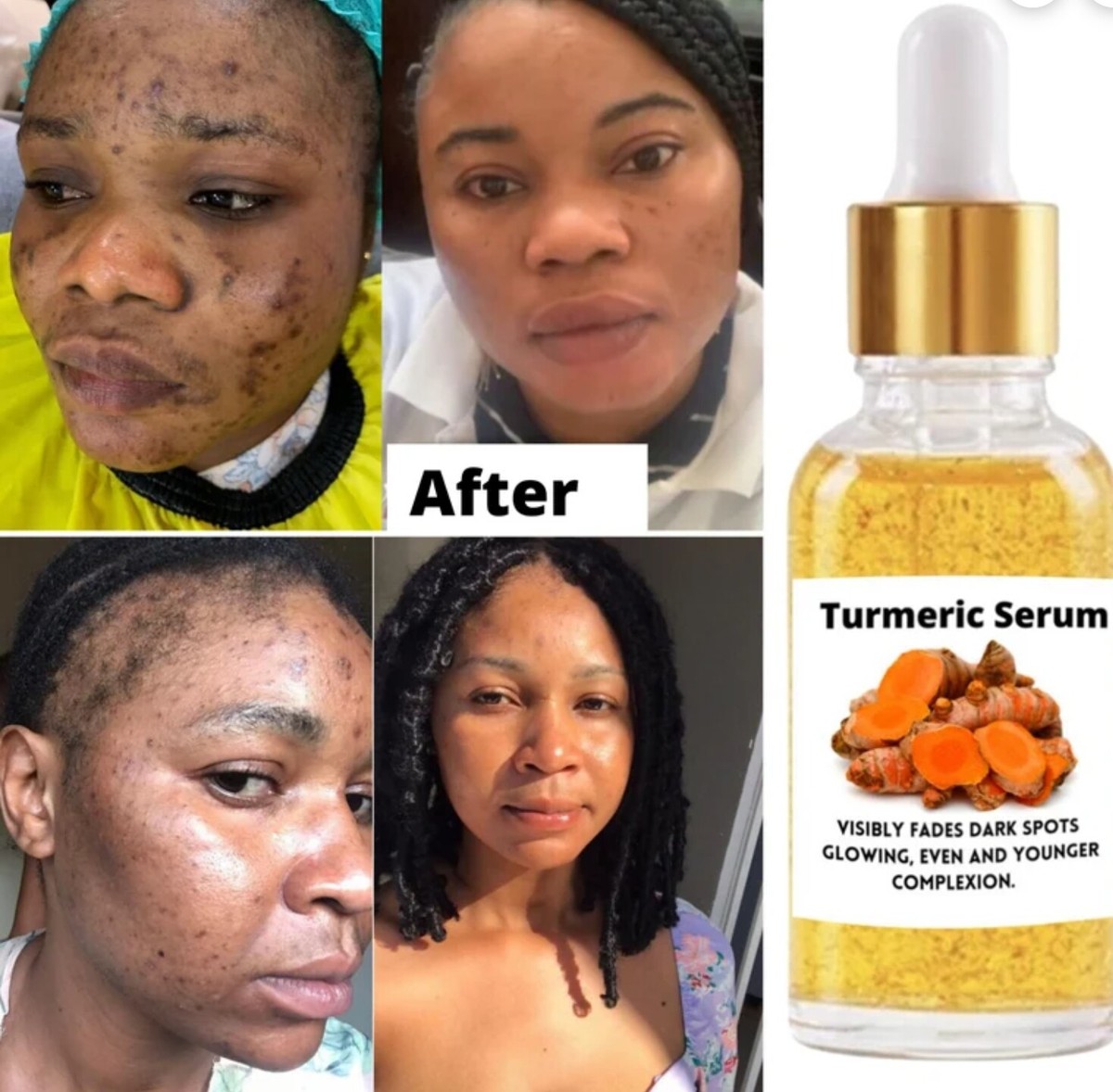 Sérum Au Curcuma Pour Taches Sombres - 30 Ml, FPS 2, Pour Peau Éclatante - Neuf