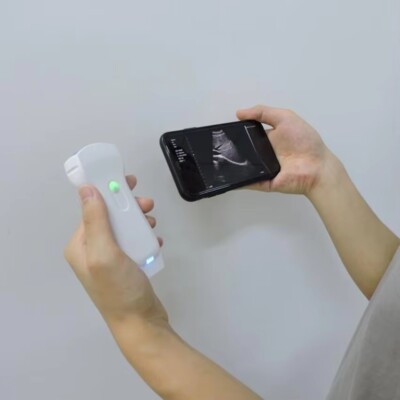 Color Doppler 128 Elements Wireless Ultrasound 3 in 1 Probe Convex/Linear