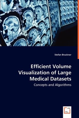 Bruckner - Efficient Volume Visualization of Large Medical Datasets -  - X555z