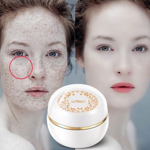 cream for freckles on face