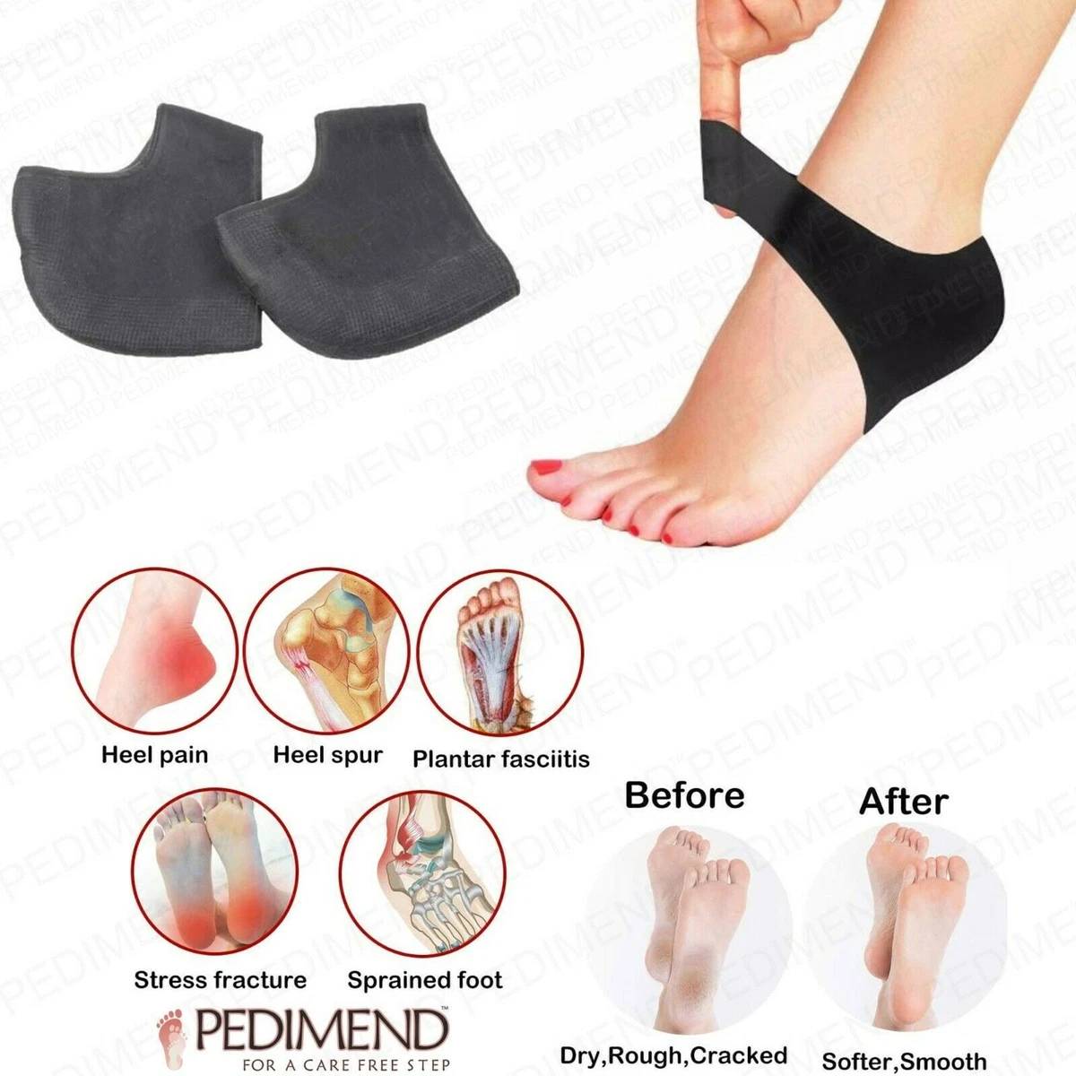 Heel Cushions Protectors Plantar Fasciitis Heel Pads Heel Cushion Inserts  Heel Cups Adjustable Breathable Heel Support for Cracked Dry Heels Heel Pain  Sponge C - Walmart.com