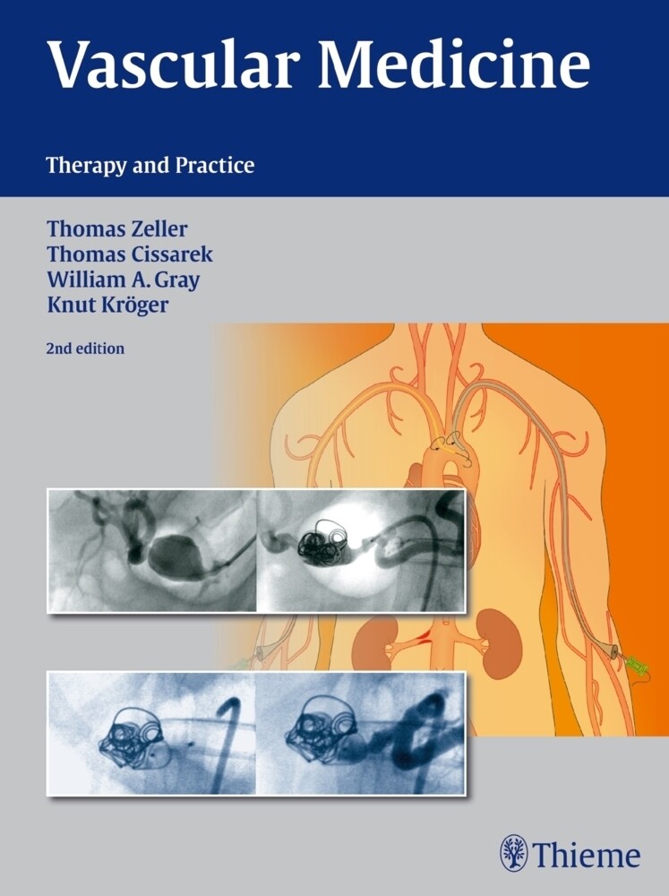 Thumbnail - Vascular Medicine Therapy And Practice Zeller Buch Hardback (thread