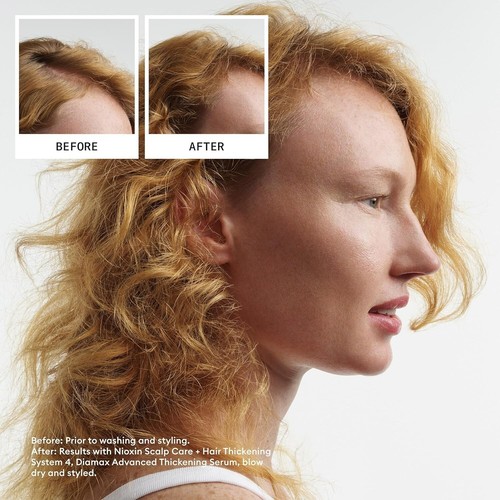 Nioxin Pro Clinical #4 Kopfhautpflege + Haarverdichtung Behandlung, 6,7 oz 200ml - Bild 4 von 12