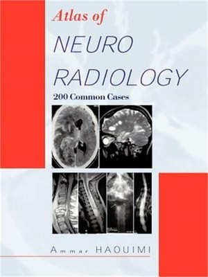 Atlas of Neuroradiology: 200 Common Cases (Paperback or Softback)