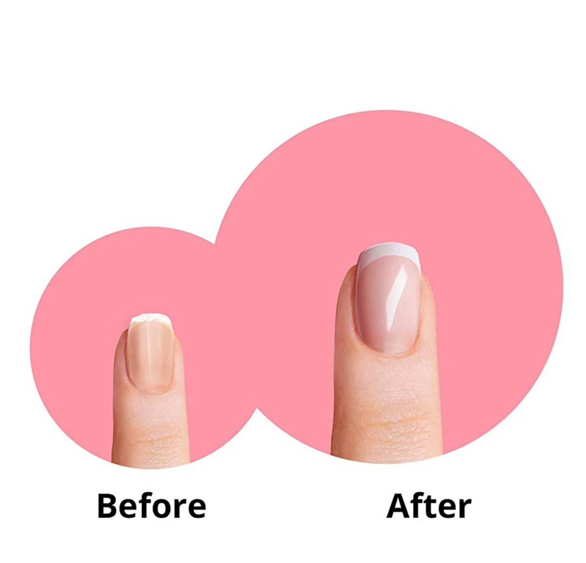 How to Treat Your Dry and Brittle Nails - The Nail Pro