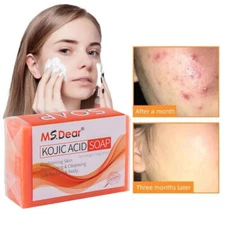 Face & Body Skin Lightening Soap Kojic Acid Soap Acne Dark Spot Remover 100g