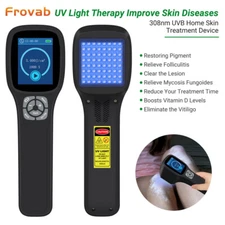 308nm Light Treatment for Skin rejuvenation Lightening Blue Light Face Troubles