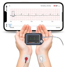 Chckme EX EKG Gerät für zuhause mit Kabel 30s/60s/5min Aufzeichnung + KI-Analyse