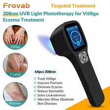 308nm Excimer Uvb Light Therapy Phototherapy Device for Skin Diseases Home Use