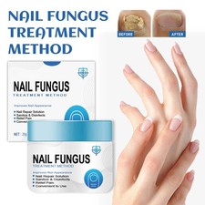 Natural Anti Fungal Treatment Gray Nails Repair Nourishing Fungus Solution