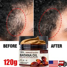 Natural Batana Oil Conditioner For Hair Growth Anti Hair Loss Treatments Unisex