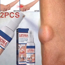 2PCS Lipomheilung Reduction Spray, Instant LumpFree Lipoma Removal Spray USA Hot
