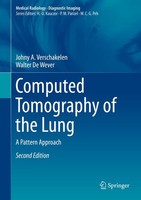 Computed Tomography Of The Lung ~ Walter De Wever ~ 9783642395178