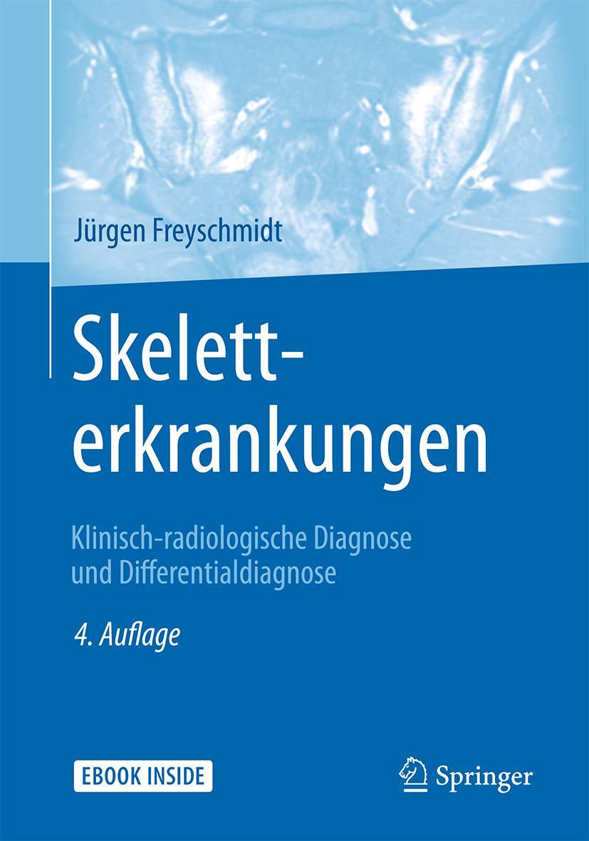 Skeletterkrankungen Jürgen Freyschmidt
