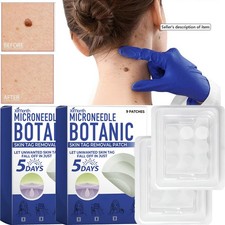 2 Box /18 pcs MICRONEEDLE BOTANIC Skin Tag  Acne Patch Skin Tag Remover Patches