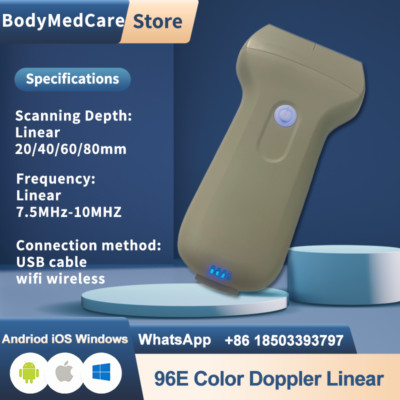 96 Elements Wireless Ultrasound Linear/Convex Color Doppler USB&WiFi