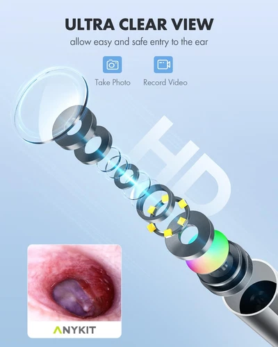 Anykit Digital Otoscope - Thumbnail 5