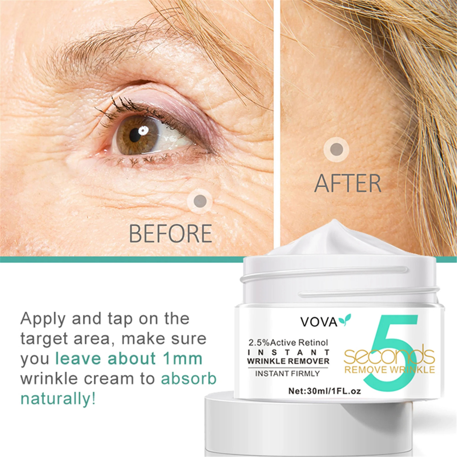 Anti-Aging Eye Cream – Instant Wrinkle Remover, Dark Circles & Puffiness Reducer