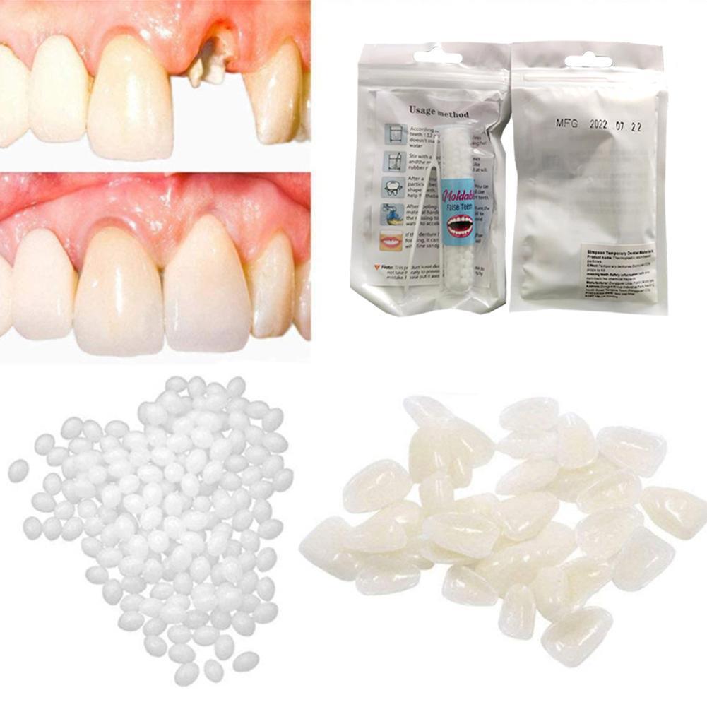 5-20g Temporary Tooth Repair Kit Teeth And Gaps False Teeth Glue Denture~Ð