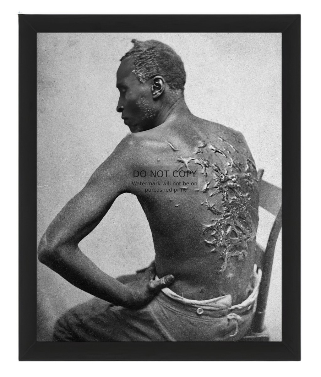 AFRICAN AMERICAN SLAVE ENSLAVED MANS SCARRED BACK 1863 8X10 FRAMED