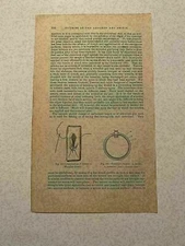 KP203) Application of Suture to Wounded Bowel Medical 343 1878 Engraving