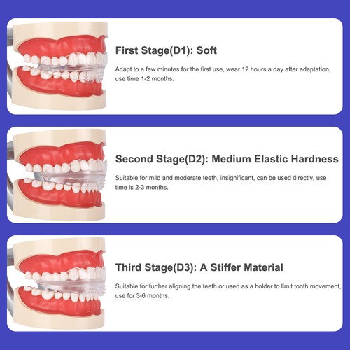 3 Stage Dental Orthodontic Teeth Corrector Braces Retainer Alignment Trainer NEW - Picture 9 of 16