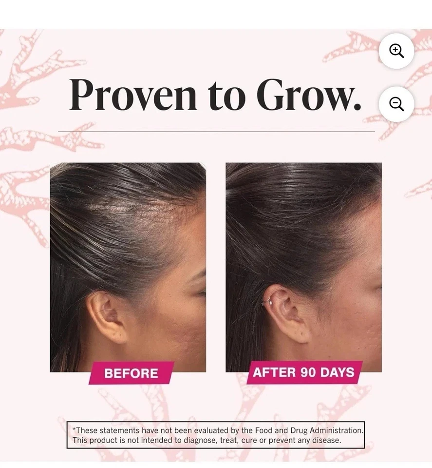 NUEVO Suplemento Viviscal Crecimiento del Cabello para Mujer 180 Comprimidos - Suministro para 3 Meses Foto 2 de 4