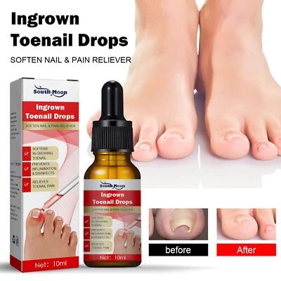 MARKENLOS Toenail Correction Ingrown Nail Treatment Essence Oil Nail Nutrition Nourish Oil