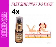 ⭐FAST SHIPPING⭐ 4 X 30ml Hemani ant oil 100% original , زيت النمل هيماني الاصلي